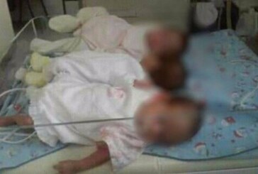 San Justo | Trillizas en busca de un hogar
