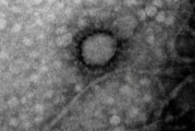 Coronavirus | El Instituto Malbrán y UBA CONICET lograron capturar la primera foto del Covid-19 que circula en Argentina