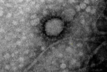 Coronavirus | El Instituto Malbrán y UBA CONICET lograron capturar la primera foto del Covid-19 que circula en Argentina