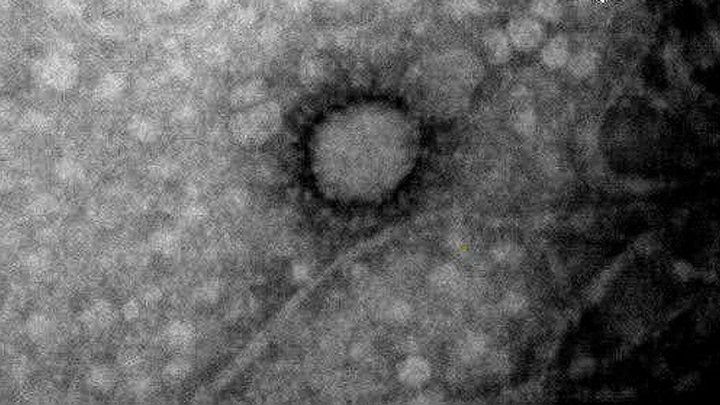 Coronavirus | El Instituto Malbrán y UBA CONICET lograron capturar la primera foto del Covid-19 que circula en Argentina