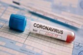 Morón | Se confirmaron 15 nuevos casos de coronavirus en el distrito y ya se realizaron más de 2 mil testeos
