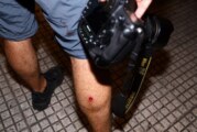 Represión en Congreso | Trabajadores de prensa y de organismos de Derechos Humanos heridos por balas de goma